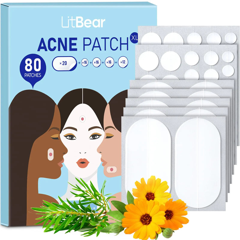 LitBear Large Acne Pimple Patches, 5 Sizes 80 Patches for Large Breakouts, Acne Patches for Face, Chin or Body, Acne Spot Patch with Tea Tree & Calendula Oil, Hydrocolloid Bandages for Acne Skin 80 Count (Pack of 1)