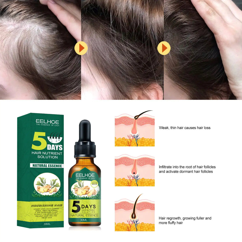 Eelhoe Ginger Hair Essential Oil. Eelhoe Ginger Hair Essential Oil